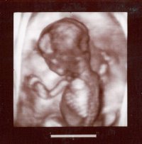 ultrasound - child
